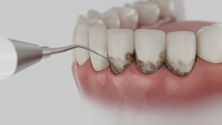Trusted Tooth Extraction service in Oakdale, CA - Dentist Open Now